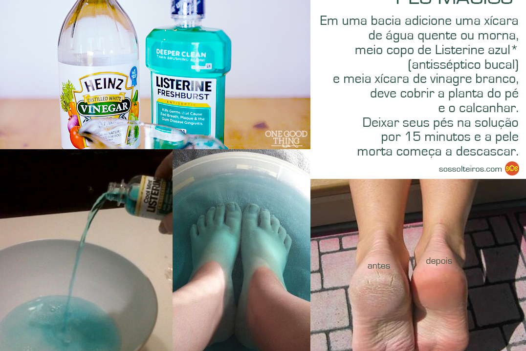 Pés Listerine