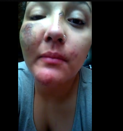 Bruna agressão homofóbica
