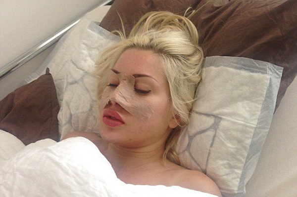 Mulher gasta mais de 450 000 reais em cirurgias plásticas para ficar parecida com Jessica Rabbit