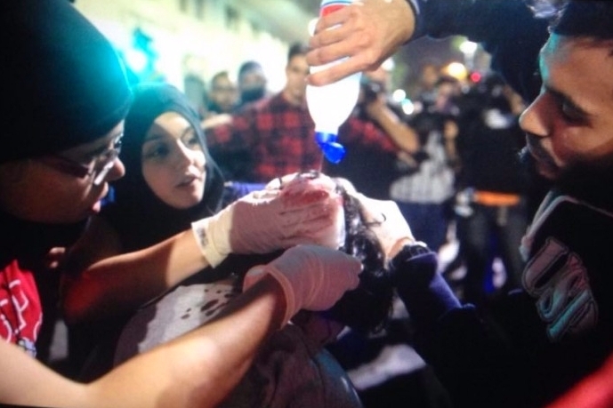 Jovem recebe tratamento após ser atropelada (Foto: Leo Feltran)