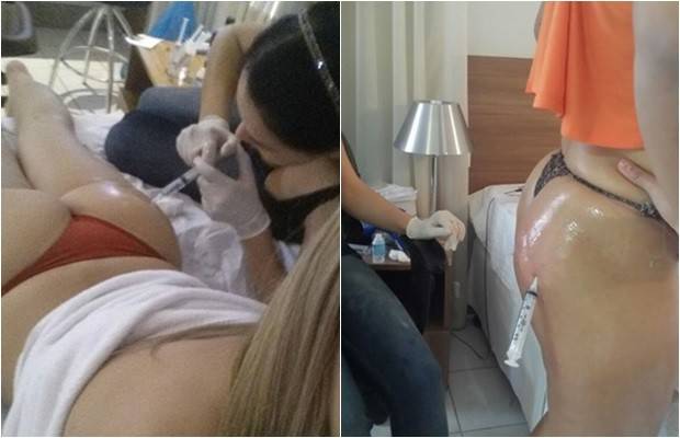 bumbum-montagem
