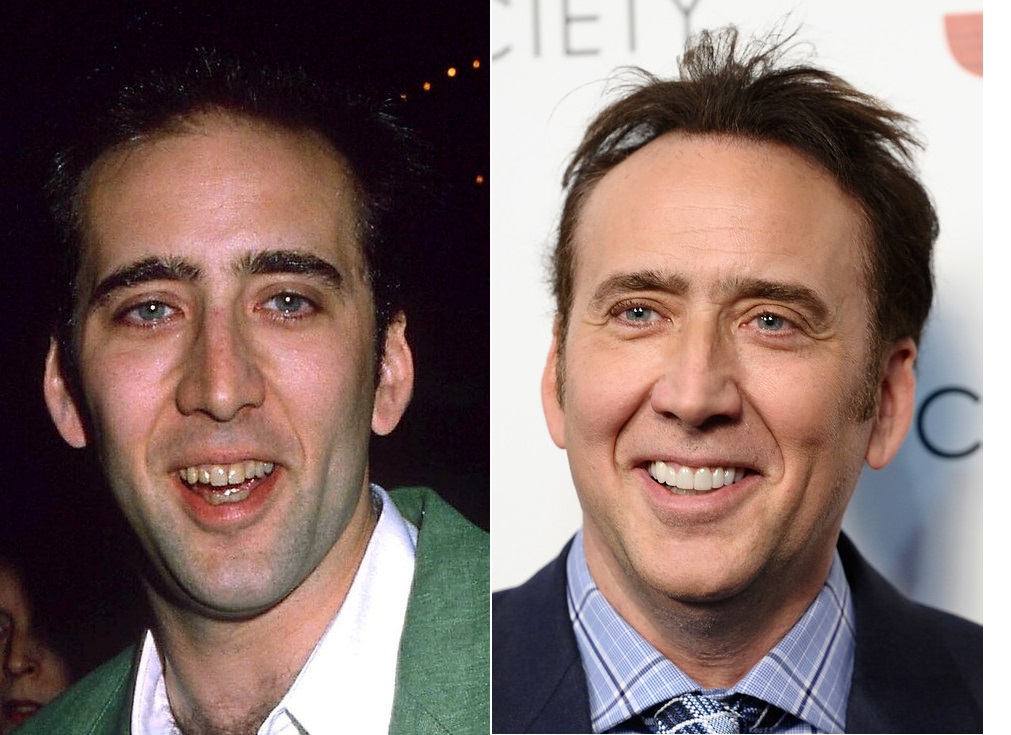 Incrível: oito atores antes e depois de passar por uma transformação dentária