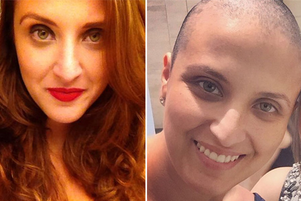 Jovem comove a internet ao mostrar rotina após descoberta de câncer de mama