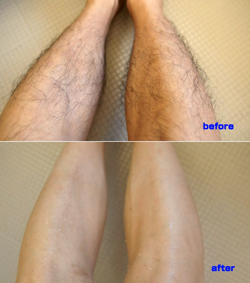 Espuma depilatória japonesa promete remover pelos com apenas um enxague