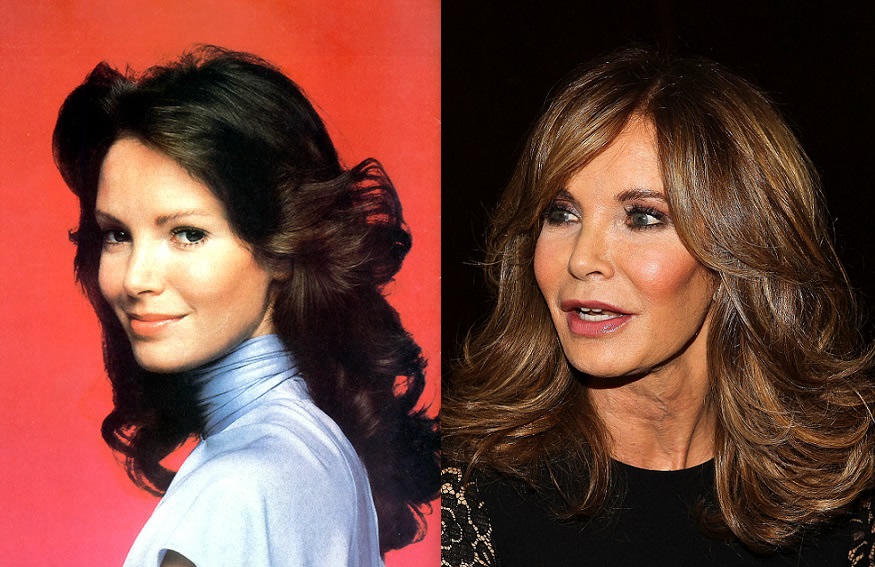 Oito atrizes que exageraram nas plásticas. Veja fotos do antes e depois