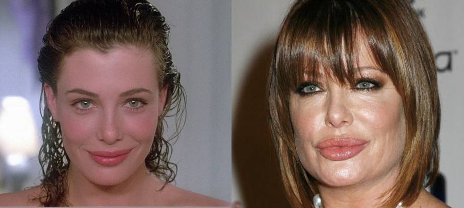 Para quem já foi a "mulher nota mil" e "a dama de vermelho", Kelly LeBrock exagerou no Botox