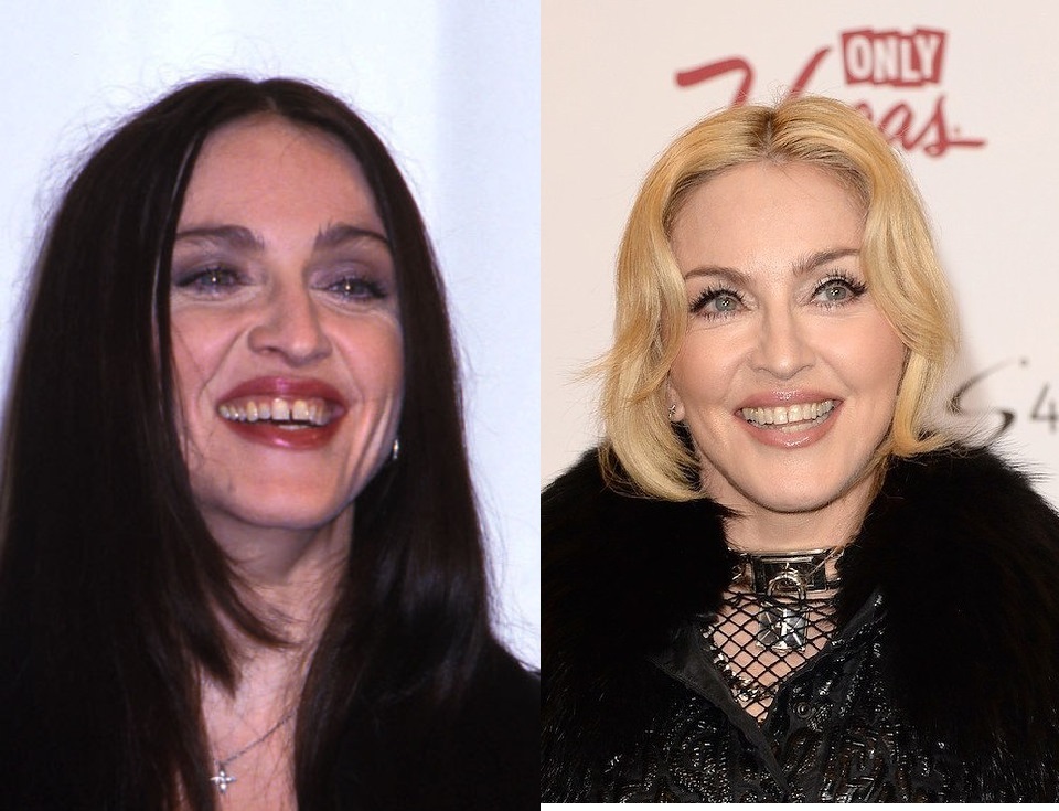 madonna