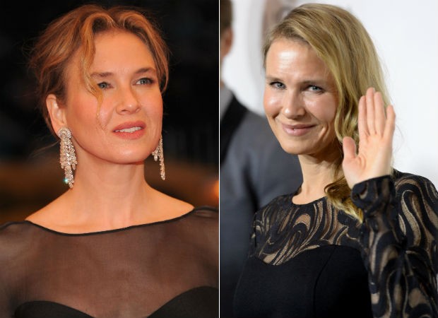 Impressionante: Renée Zellweger, a Bridget Jones, ressurge irreconhecível em evento