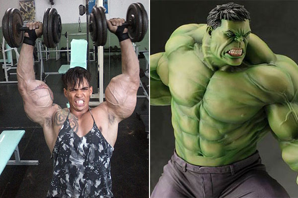 Brasileiro leva longe demais o sonho de ser Hulk e quase amputa braços
