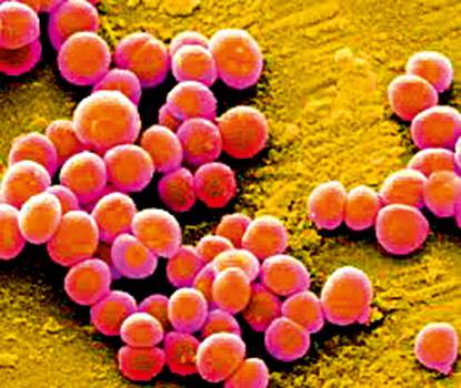 Staphylococcus aureus