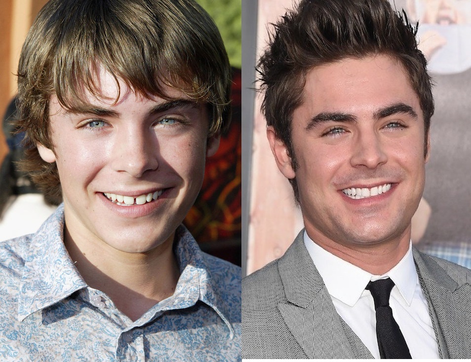 zac
