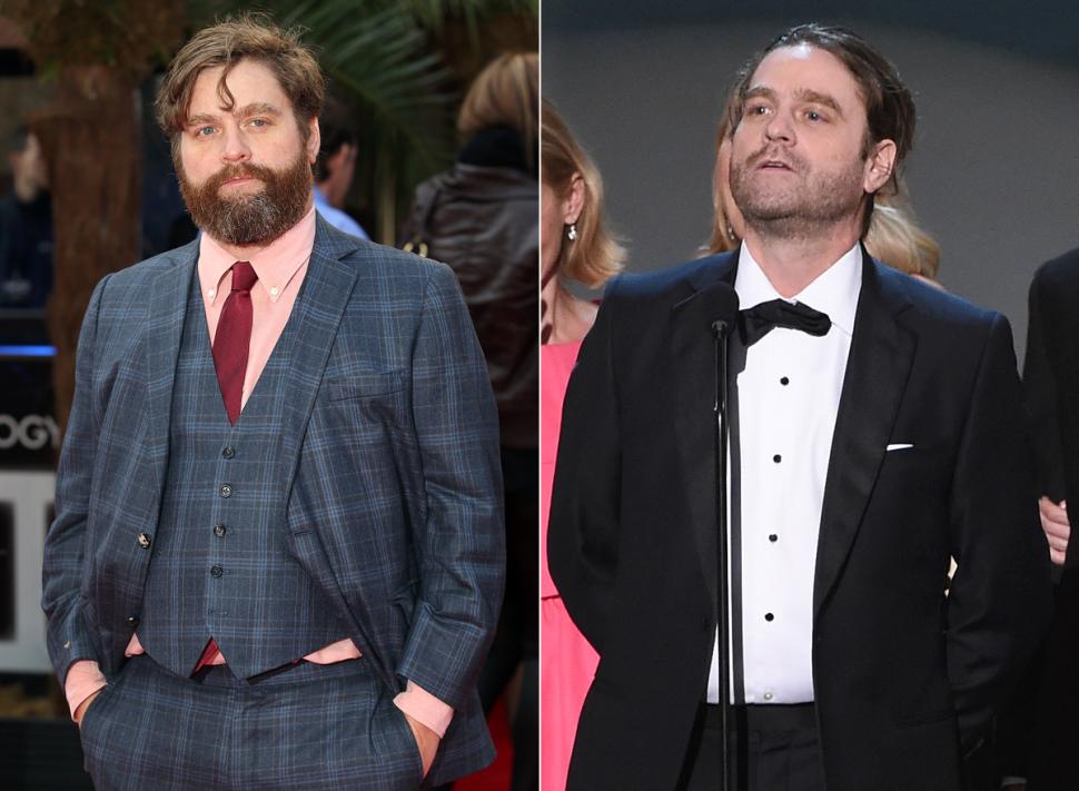 Zach Galifianakis emagreceu mais ainda e ficou irreconhecível. Veja a foto