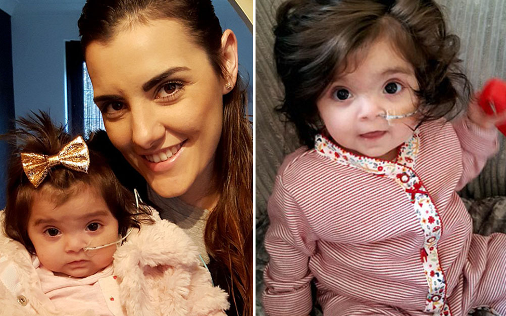 Bebê nasce com muito cabelo e é confundida com boneca