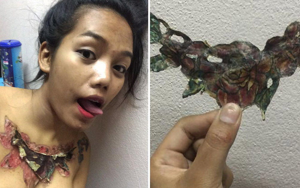 remo&ccedil;&atilde;o-tatuagem-02