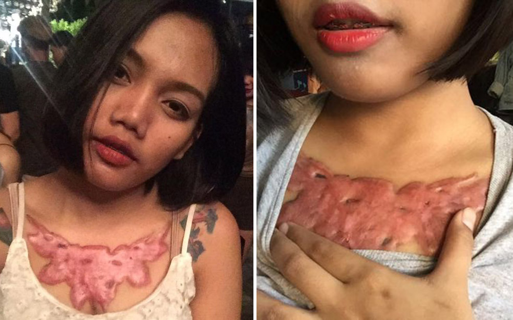 remo&ccedil;&atilde;o-tatuagem-05