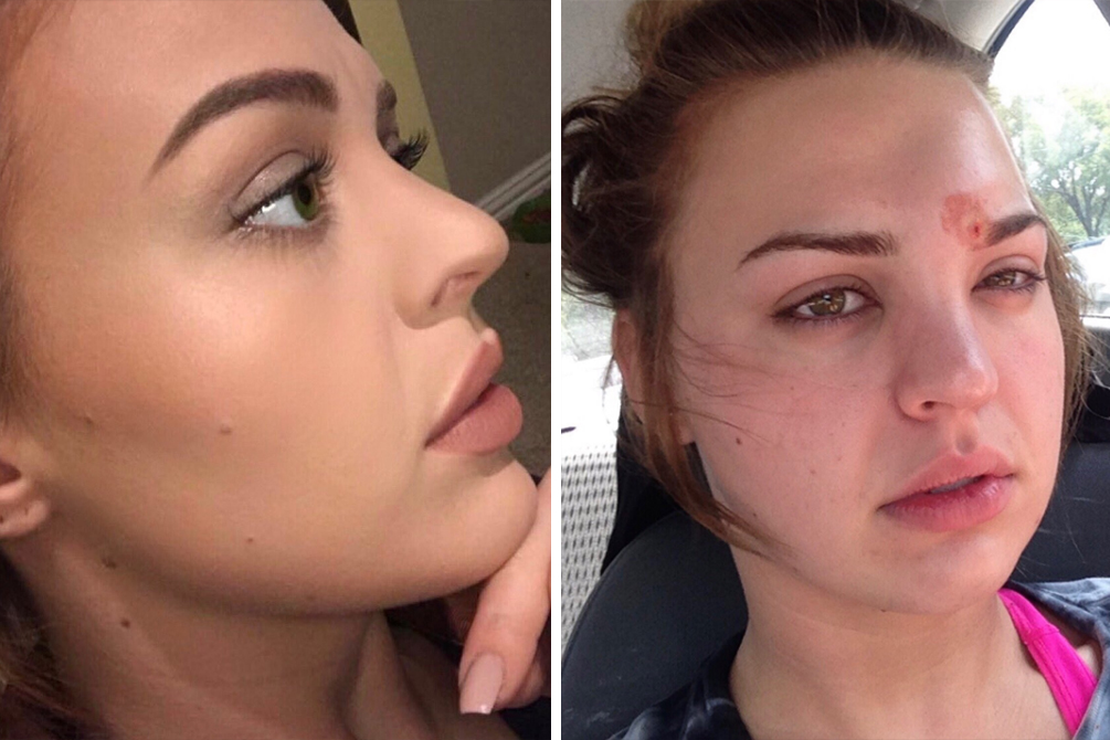 celulite-pincel-maquiagem-02