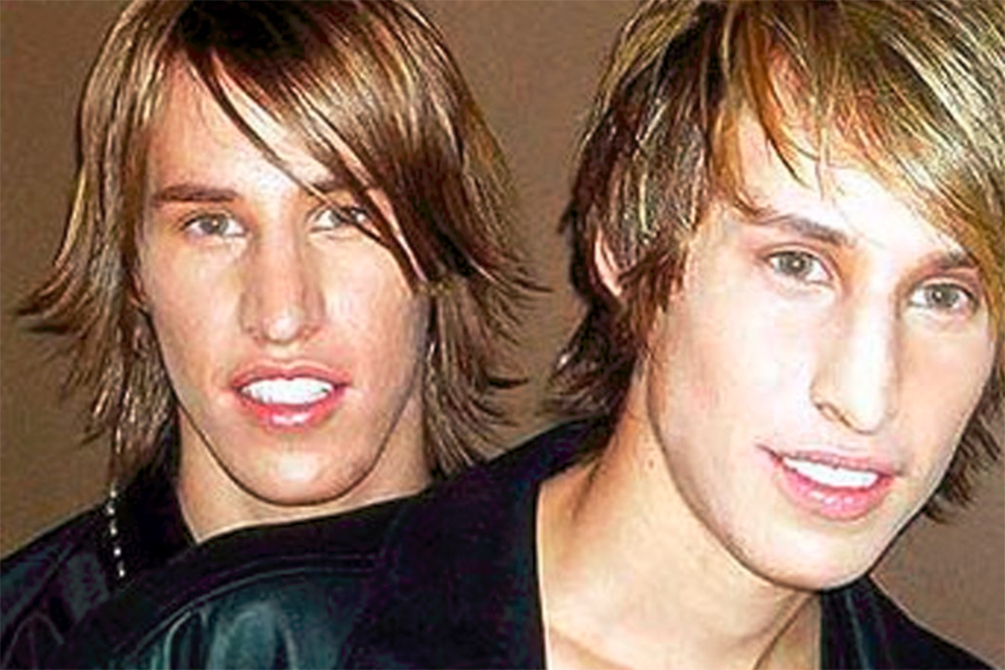 gemeos-cirurgia-plastica-brad-pitt-03