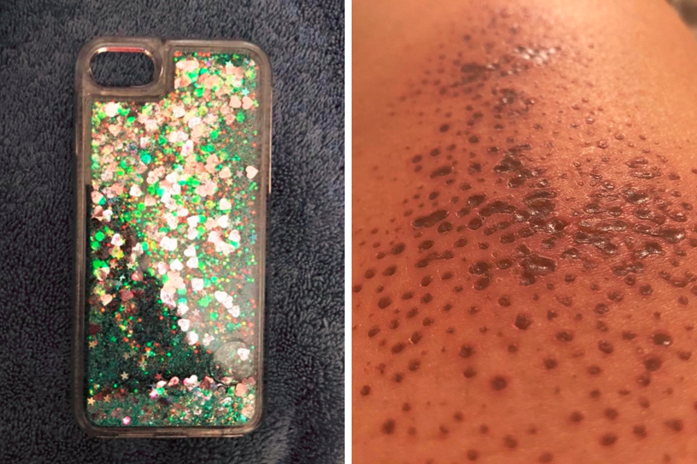 capinha-glitter-polemica-01