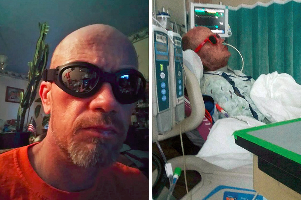 Homem fica com aparência de “zumbi” após reação a antibióticos