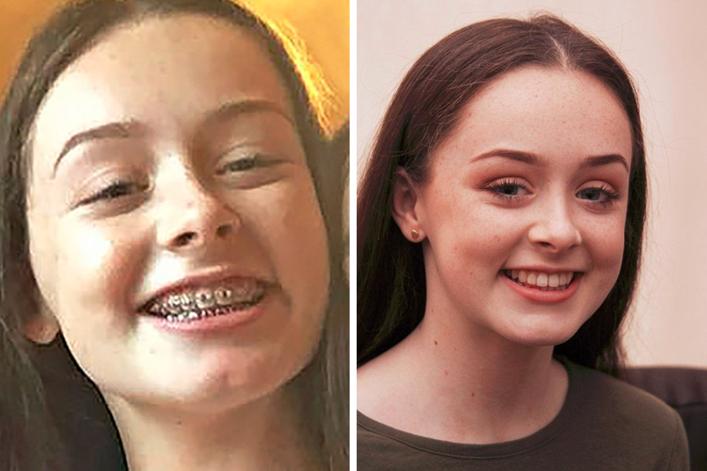 jovem-derrame-dentista-03