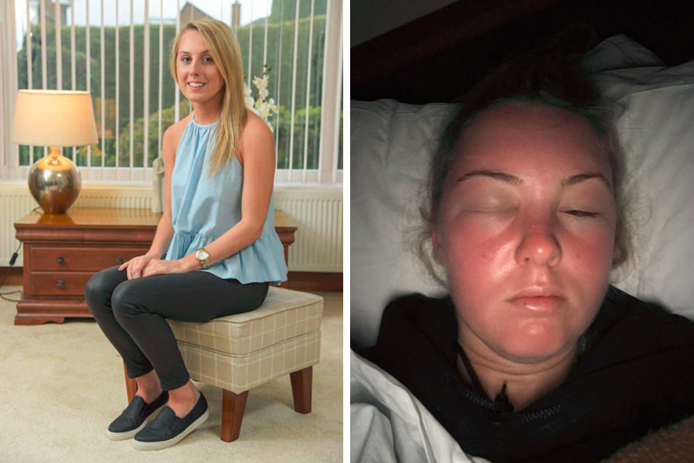 intoxicacao-solar-03