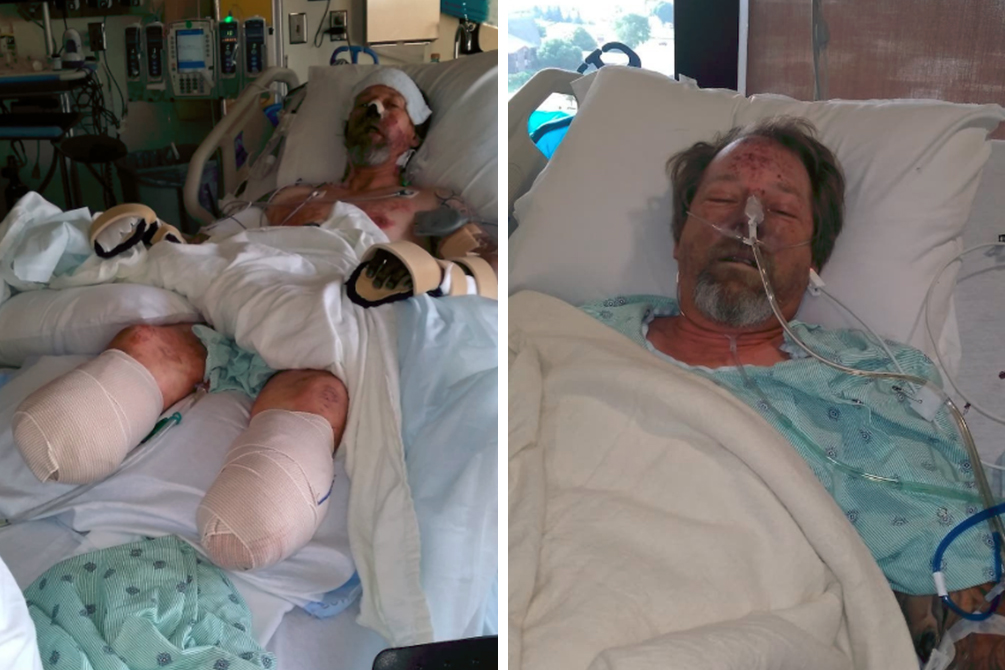 Lambida de cachorro pode ter causado amputação das pernas de um paciente