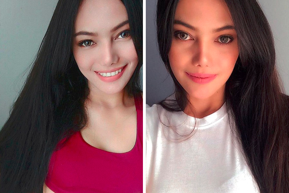 Mulher perde todos os cílios após procedimento estético em salão de beleza