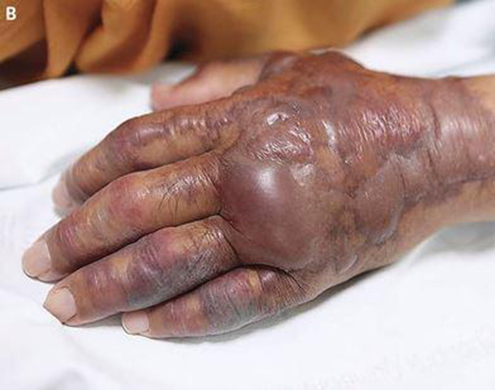 sushi-braco-amputado-02