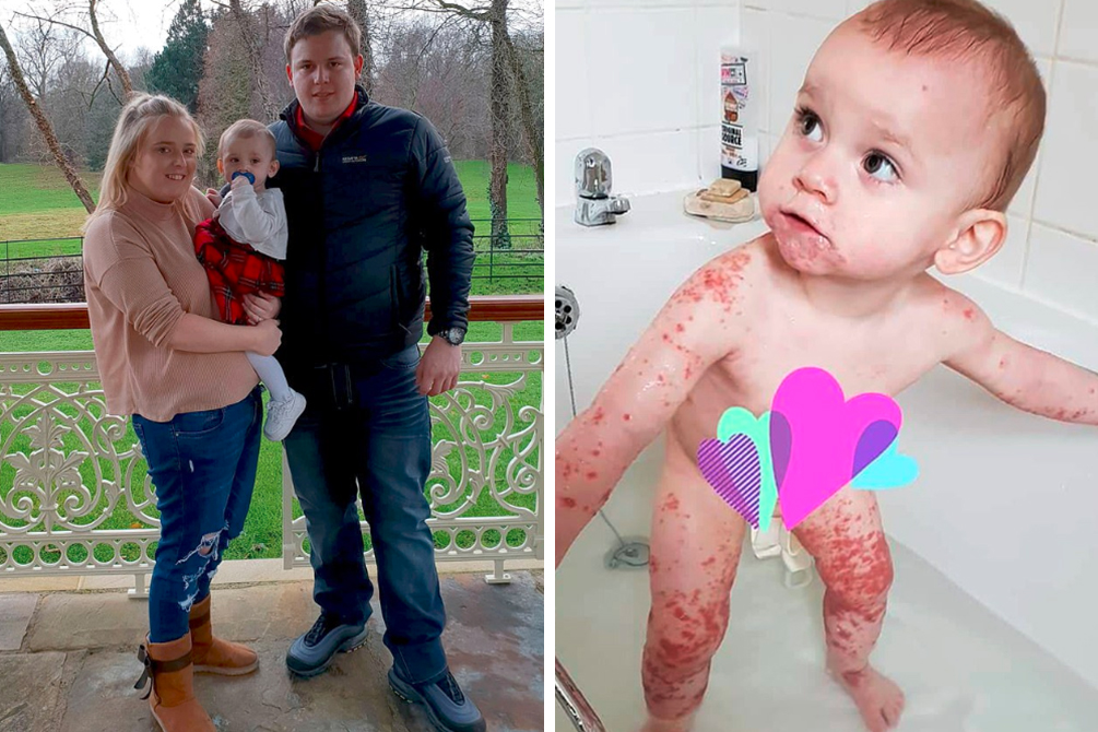 Um bebê de apenas 1 ano passou quatro dias internado após beijo de parente