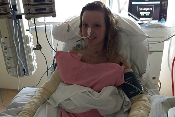 Jovem que teve 50% do corpo queimado cozinhando frango faz alerta