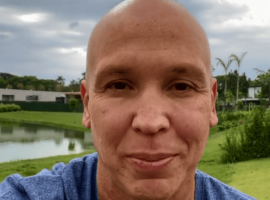 Caio Ribeiro fala sobre o diagnóstico de câncer: “Porrada no estômago”