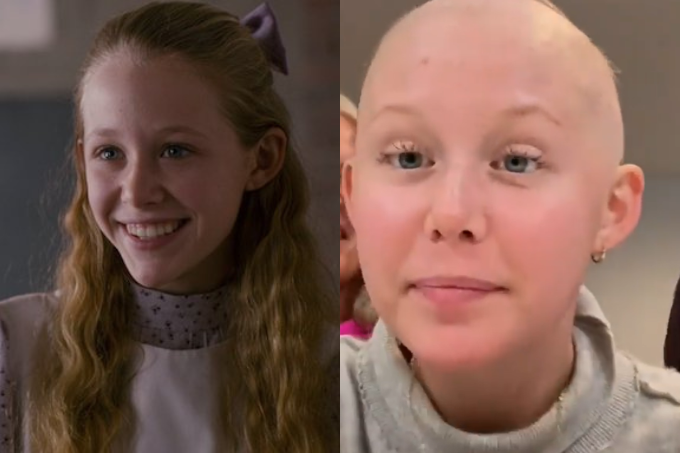 Duas fotos, uma ao lado da outra. Na esquerda, uma menina ruiva de cabelo comprido sorrindo. Na direita, a mesma menina careca.
