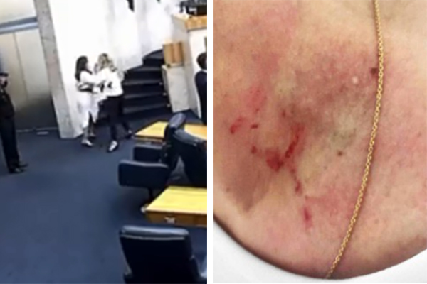 À esquerda, mulheres brigam no pé de escada do plenário da Câmara Municipal; à direita, hematomas