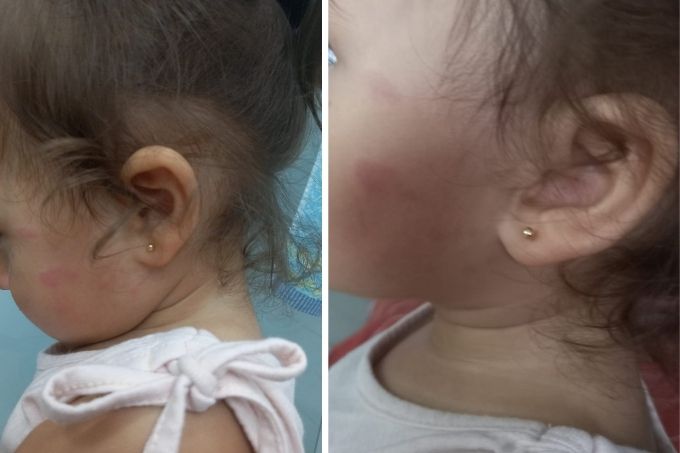 Vídeo mostra funcionária dando puxões de cabelo em bebê em escola infantil