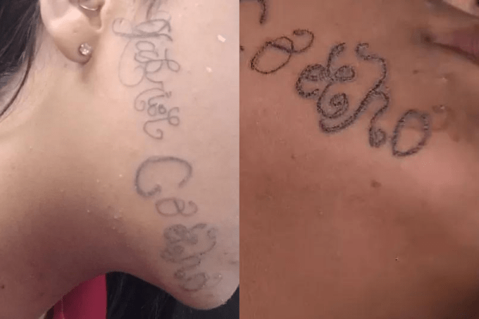 Jovem tem rosto tatuado à força com nome do ex-namorado