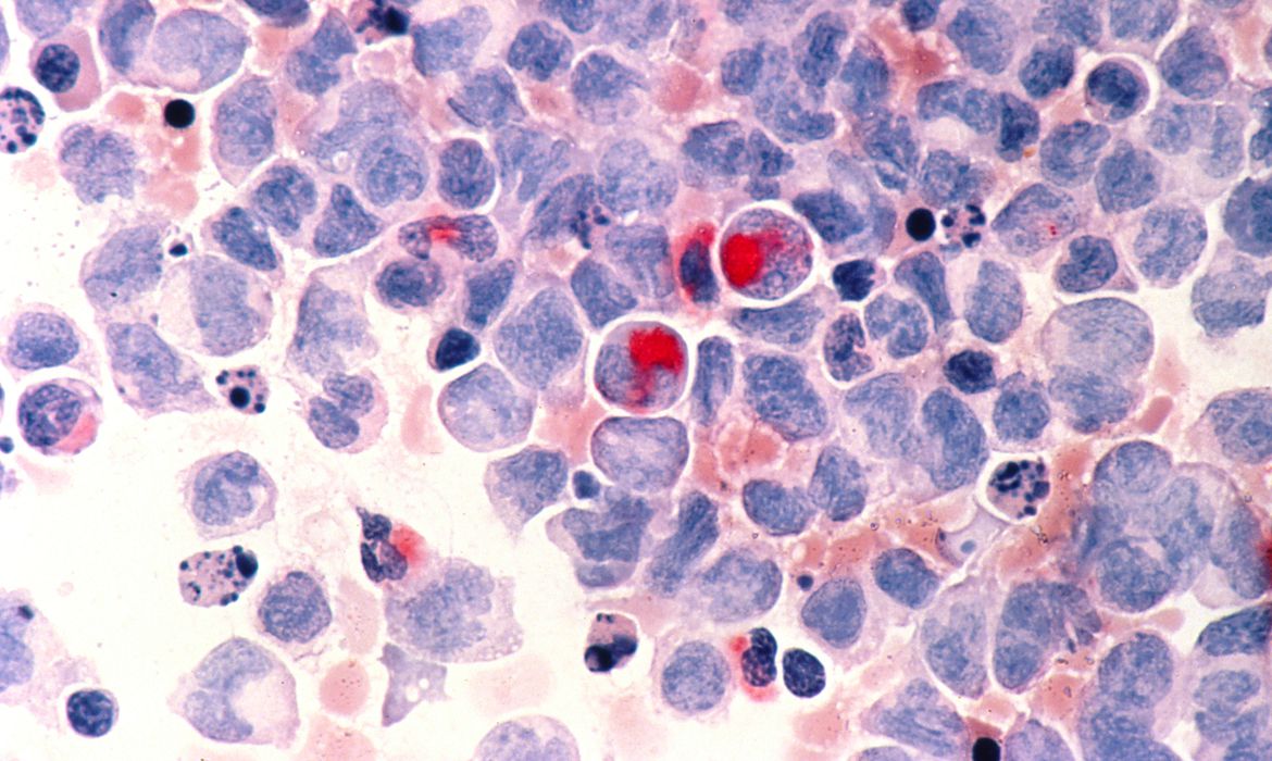 Célular cancerígenas