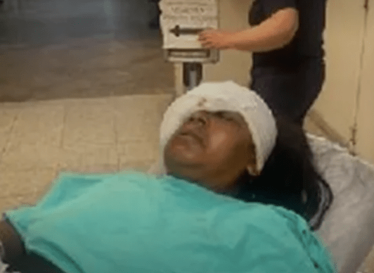 Mulher é atingida no olho por bala de borracha da PM